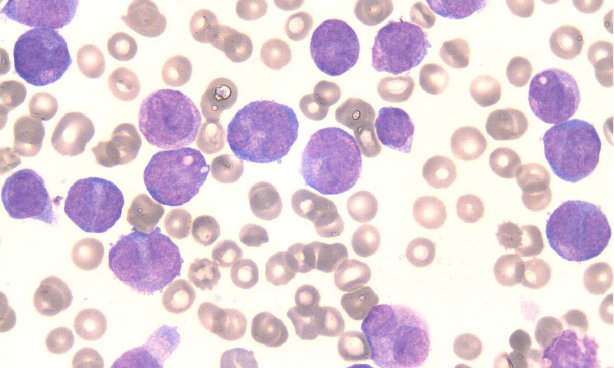 How to lift leukocytes in blood?