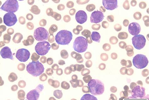 How to lift leukocytes in blood?