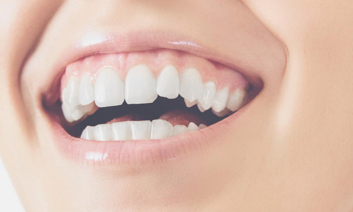 How to strengthen tooth enamel?