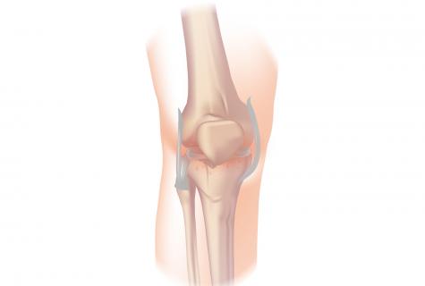 How to choose kneecaps at arthrosis of a knee joint?