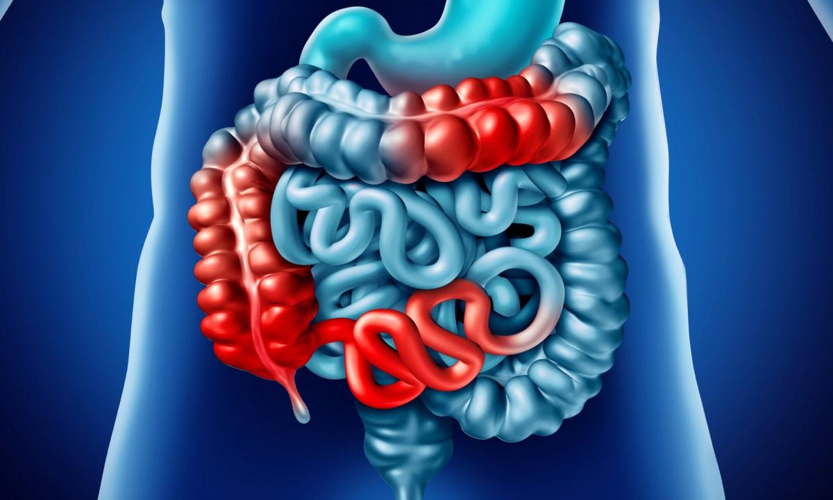 How to improve work of intestines?