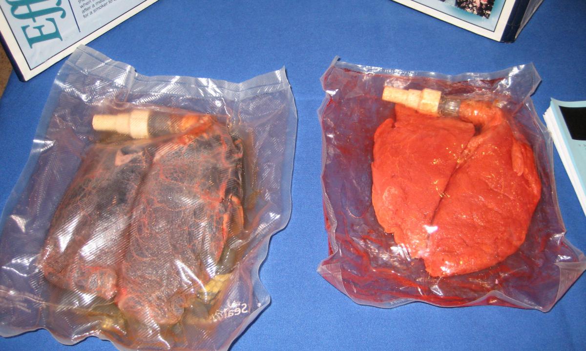 How to clean the smoker's lungs?