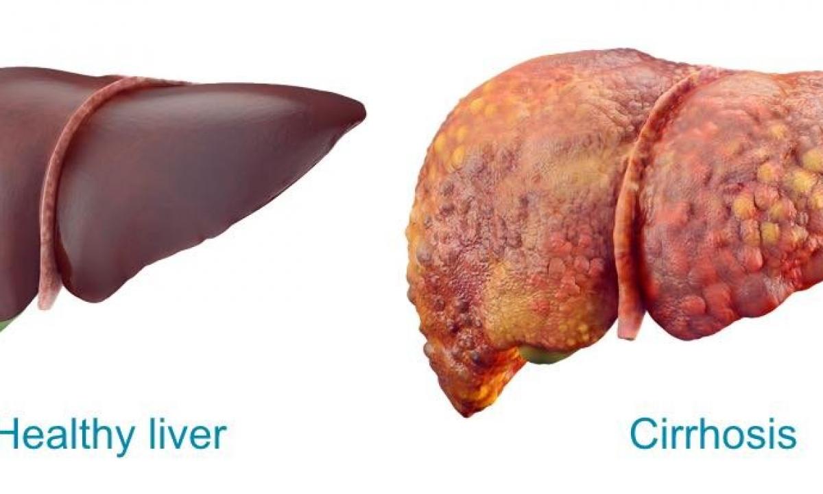 What is harmful to a liver?