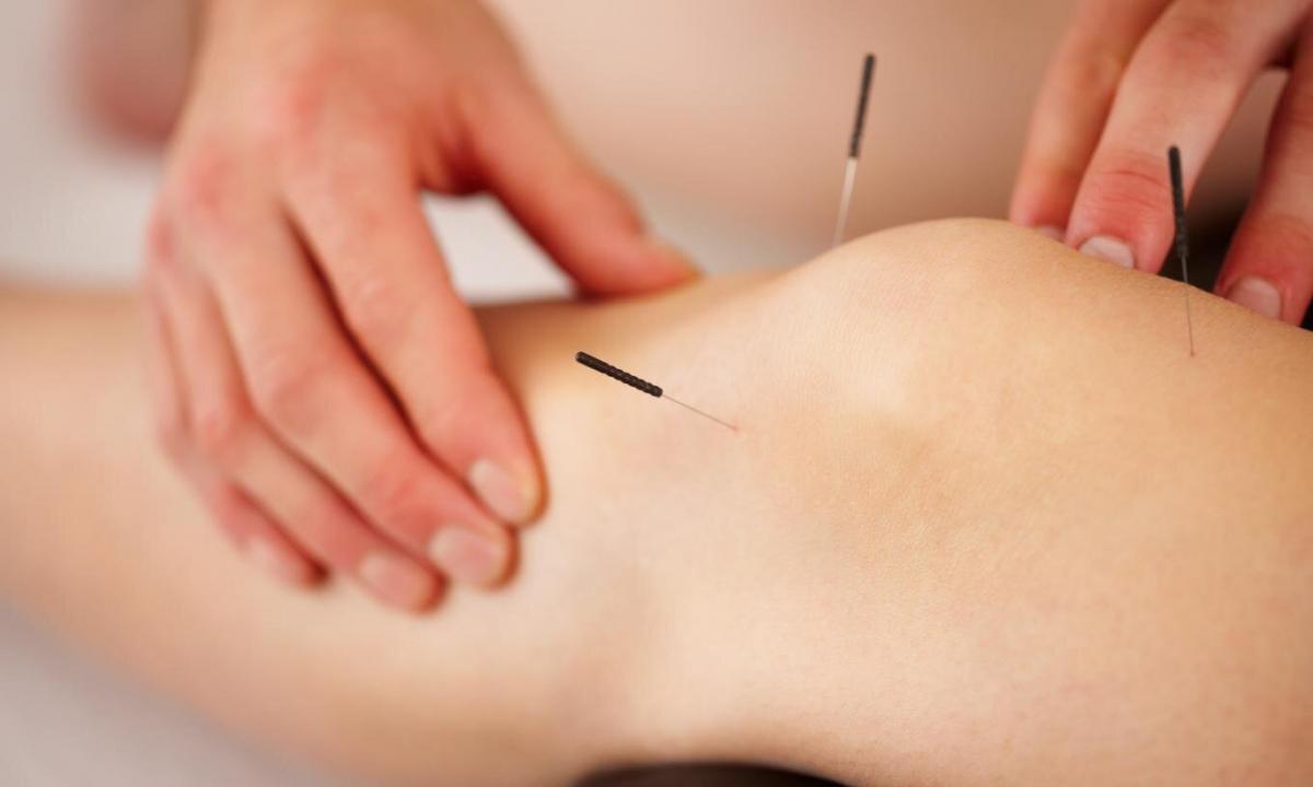 Efficiency of acupuncture: advantage or harm for an organism?