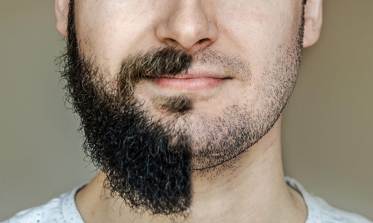 How to make beard is more dense