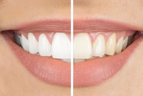How to bleach teeth iodine