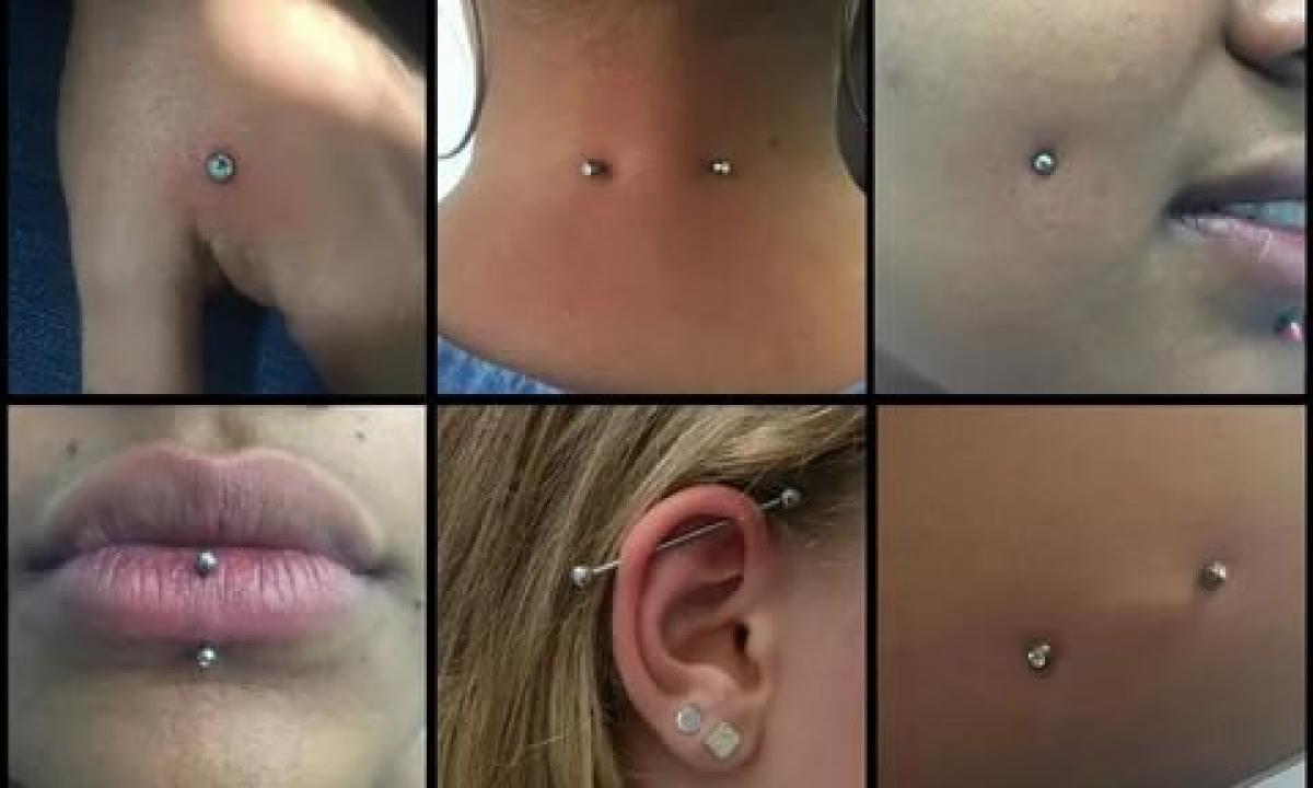 Complications after piercing
