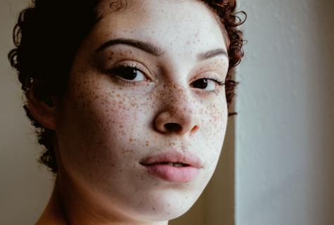 How to clarify freckles