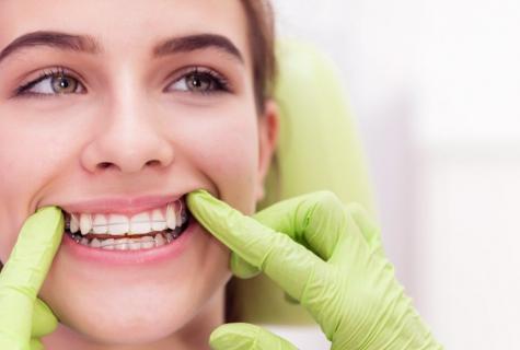 How to care for health of teeth