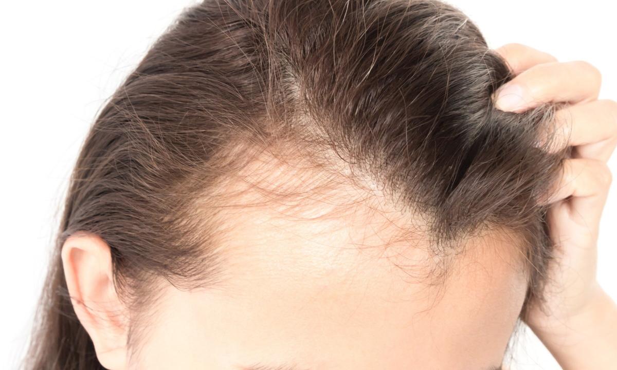 How to prevent growing of hair