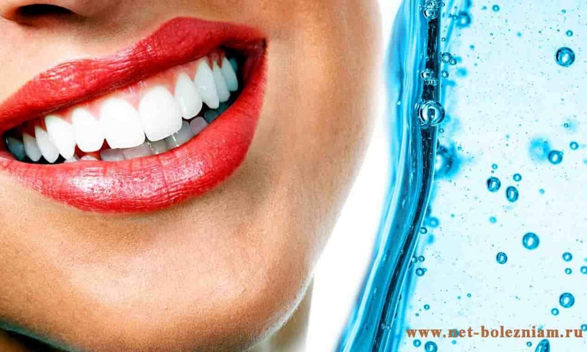 How to choose oral cavity irrigator