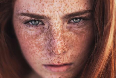 How to disguise freckles