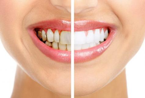 How to remove yellow raid on teeth