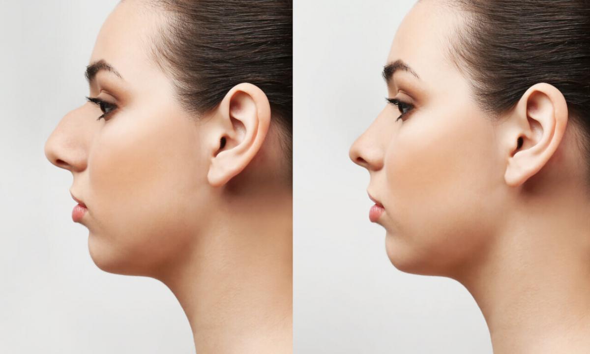 How to correct shape of the head