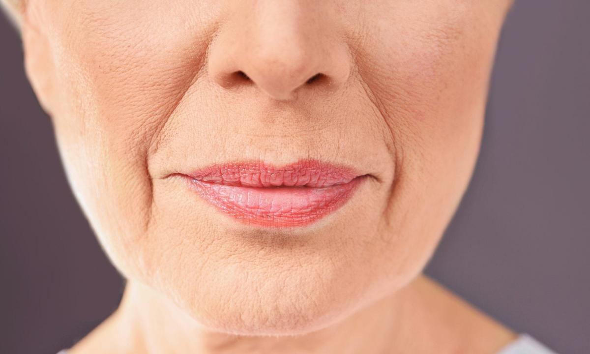 How to use filler of wrinkles