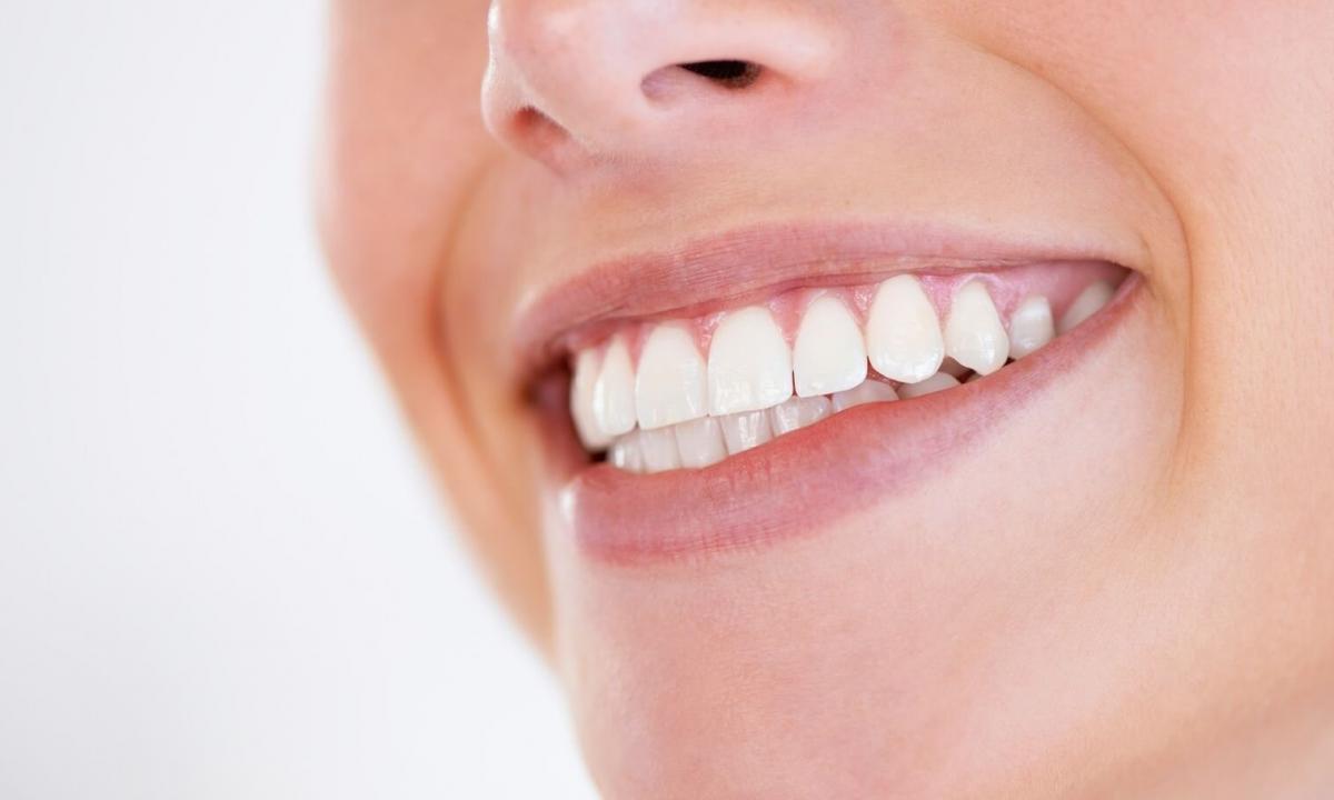Top-5 means for improvement of appearance of teeth. Beautiful teeth no problem!