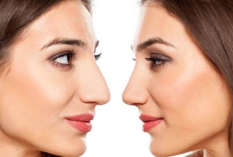 How to correct nose