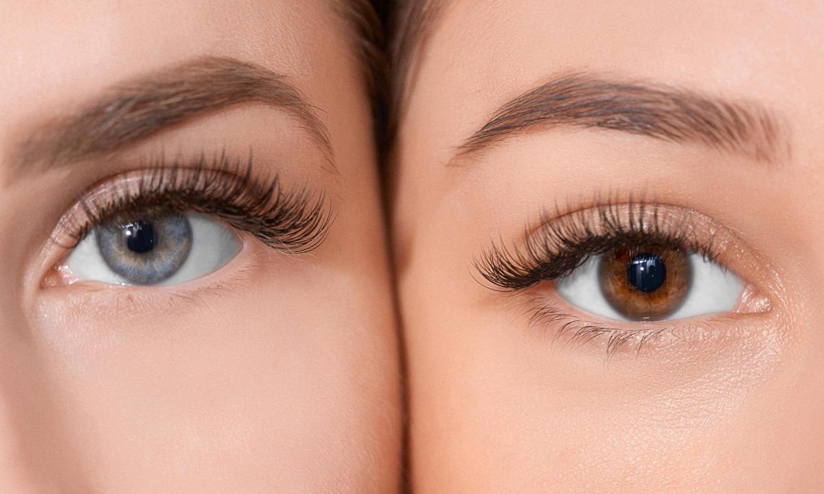 Complications after eyelash extension