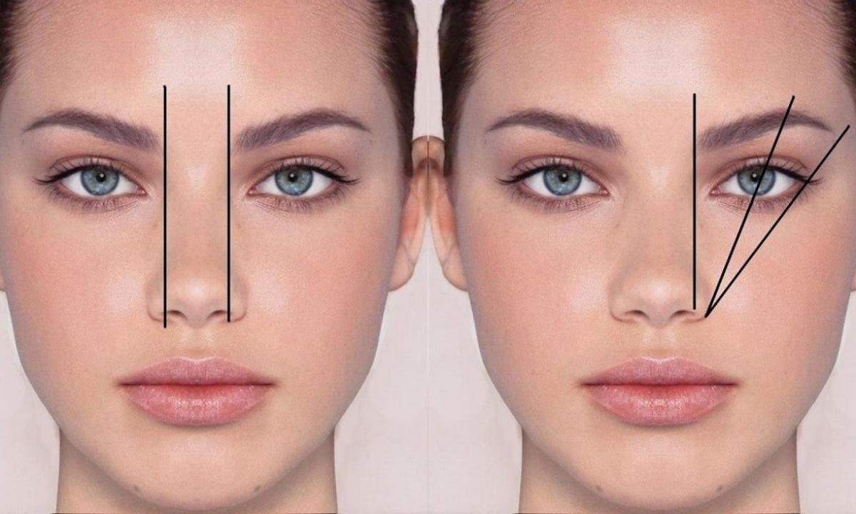 How to correct face form