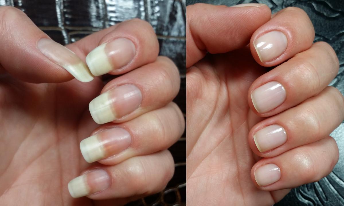 How to grow nails in month