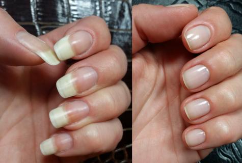 How to grow nails in month