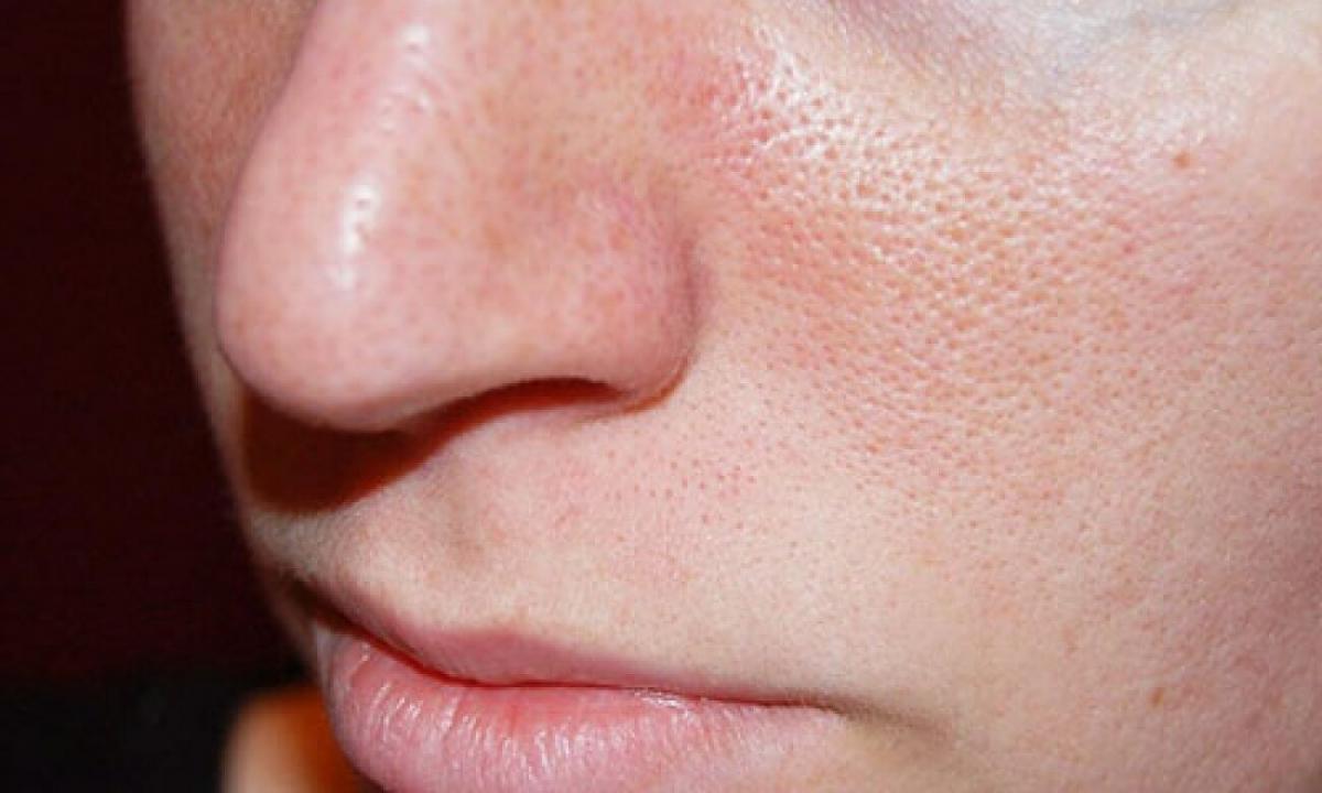 How to narrow pores on face