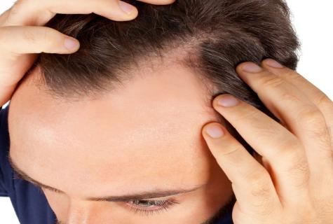 How to stimulate growth of hair on the head