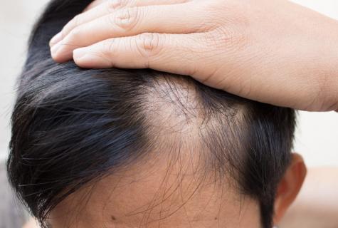 How to pick up shampoo at hair loss