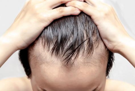 Causes of hair loss in the flying