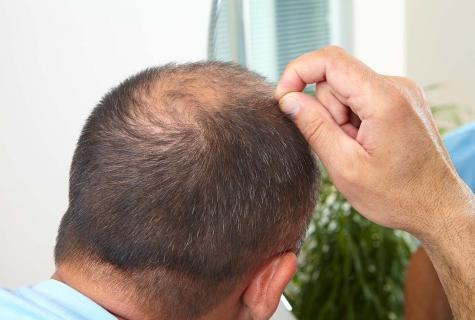 How to solve hair loss problem