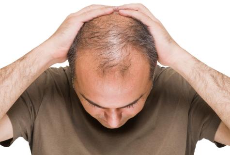What to do if baldness begins