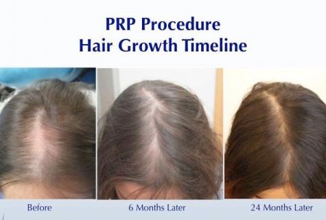 Procedures for rapid growth of hair