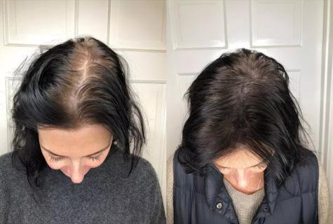 How to recover hair after loss
