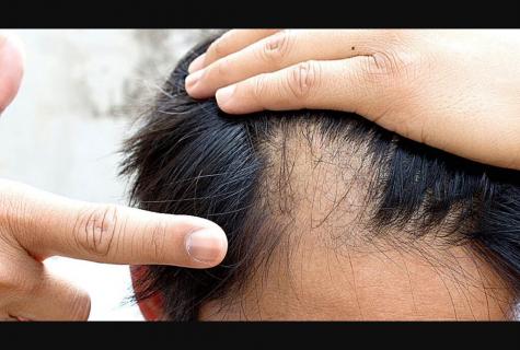 How to restore growth of hair