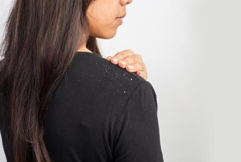 How to cope with dandruff by means of folk remedies