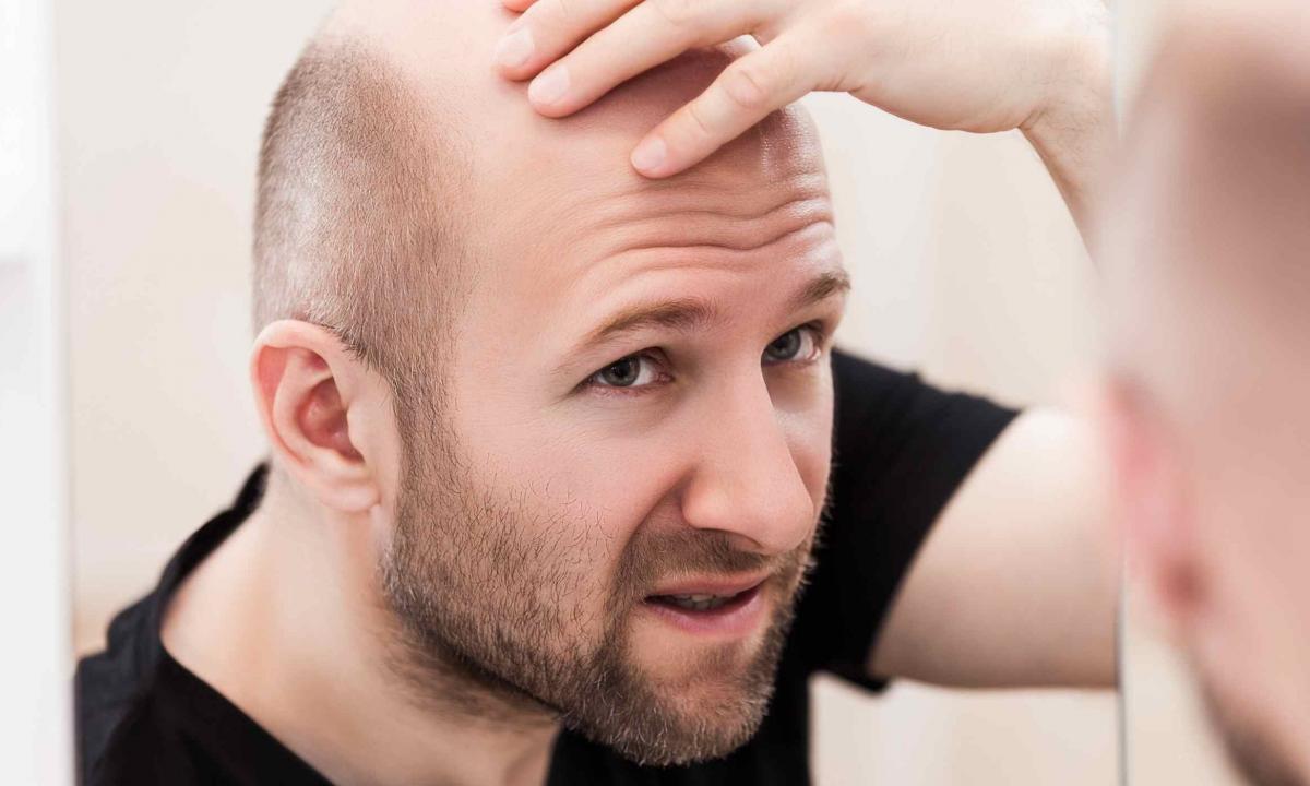 Bald head at the man: as it is possible to recover hair