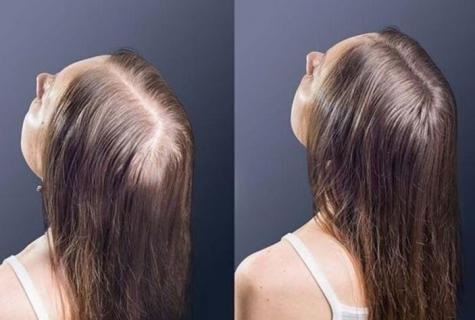 How to recover hair after clarification