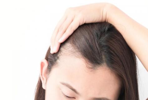 How to choose shampoo from hair loss