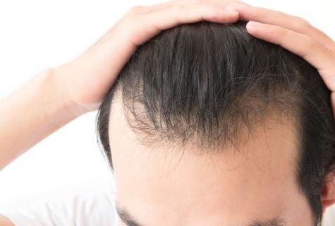 House hair loss medicines