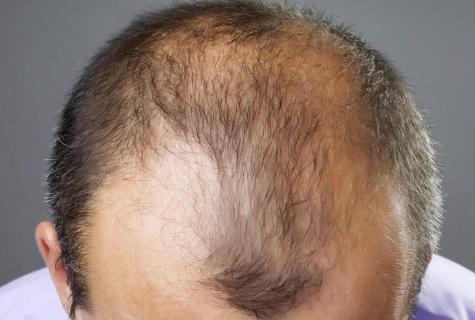 Grass broths from hair loss