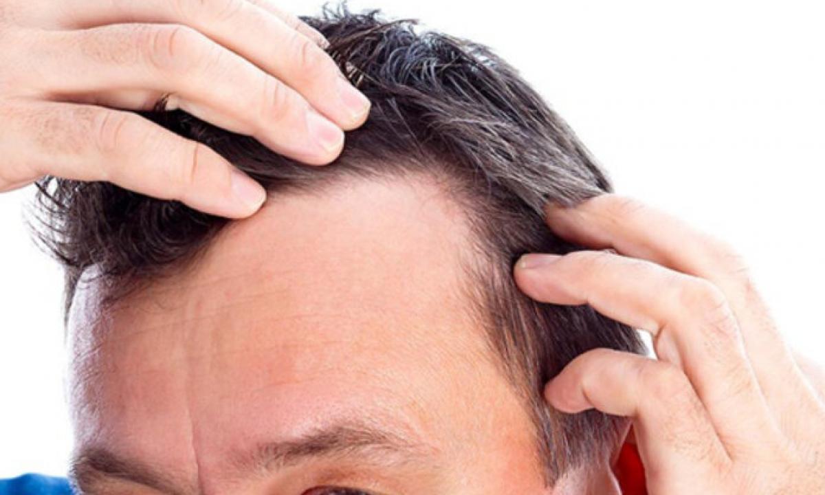 What to do from hair loss