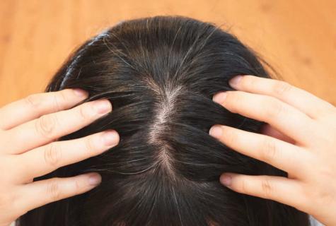 How to get rid of gray hair folk remedy