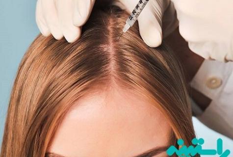 How to do head mesotherapy