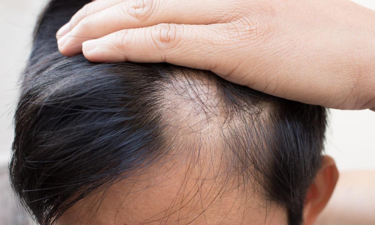 How to struggle with hair loss at lactation