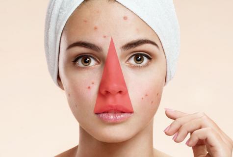 How to choose means for fight against pimples