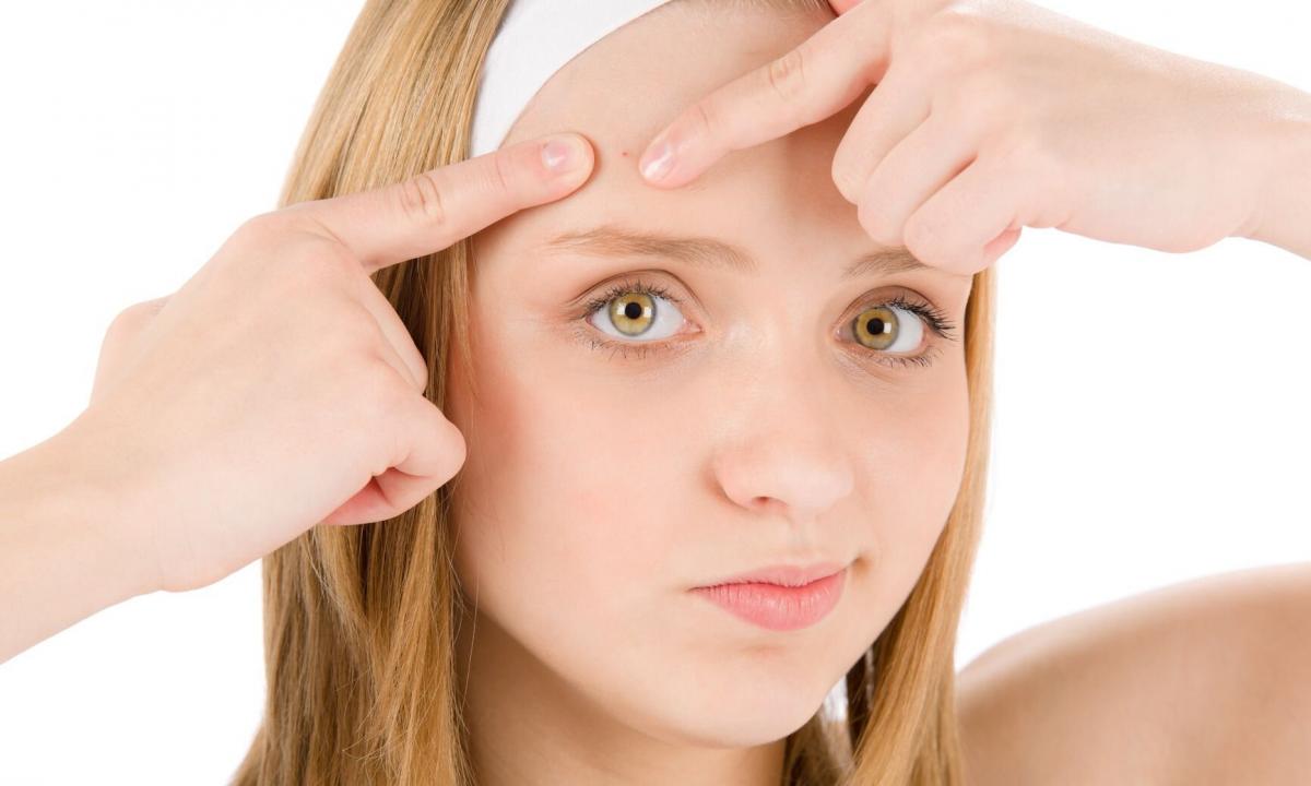 How to get rid of forehead spots
