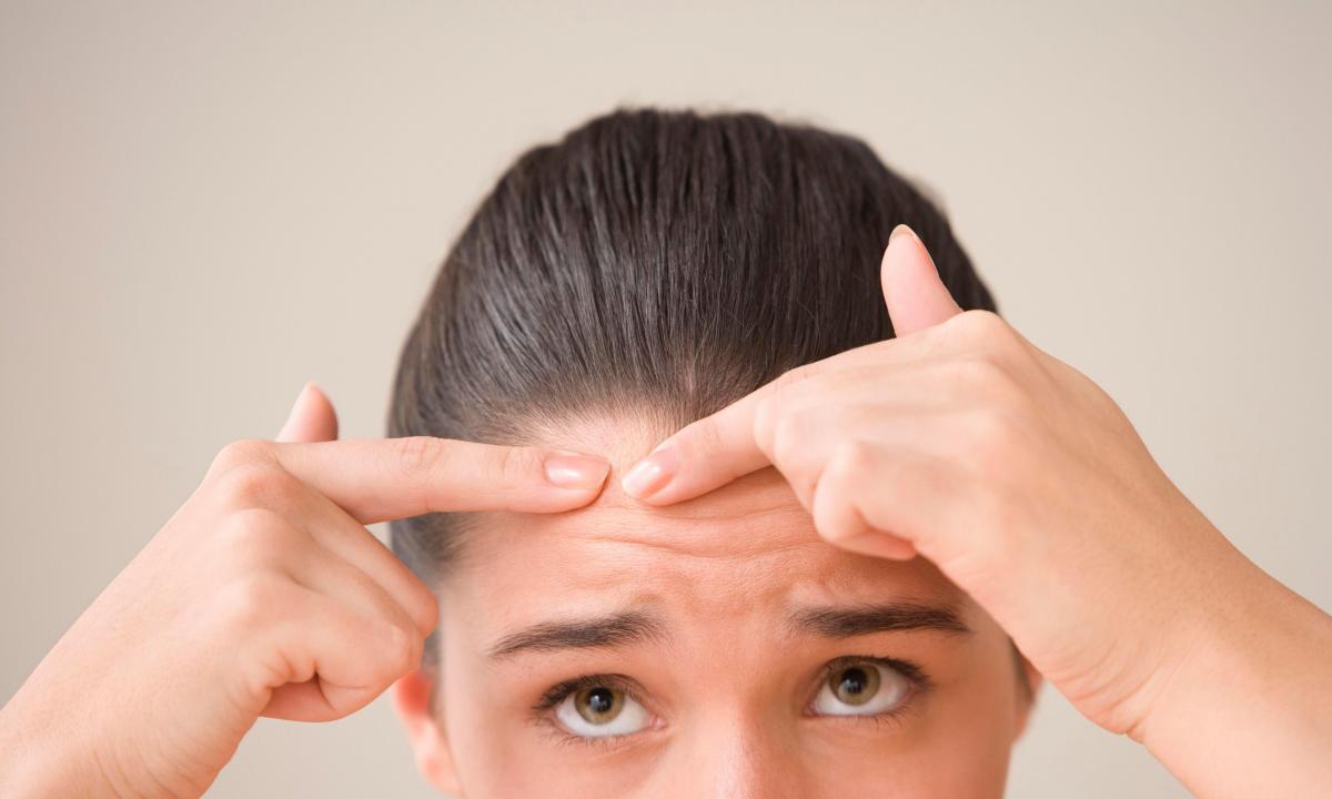 As it is easy to get rid of pimples on forehead