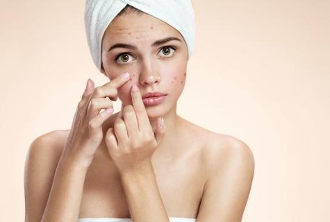 Pimples wonderful medicine in house conditions