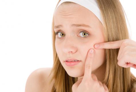 How to get rid of pimples forever: myths and reality