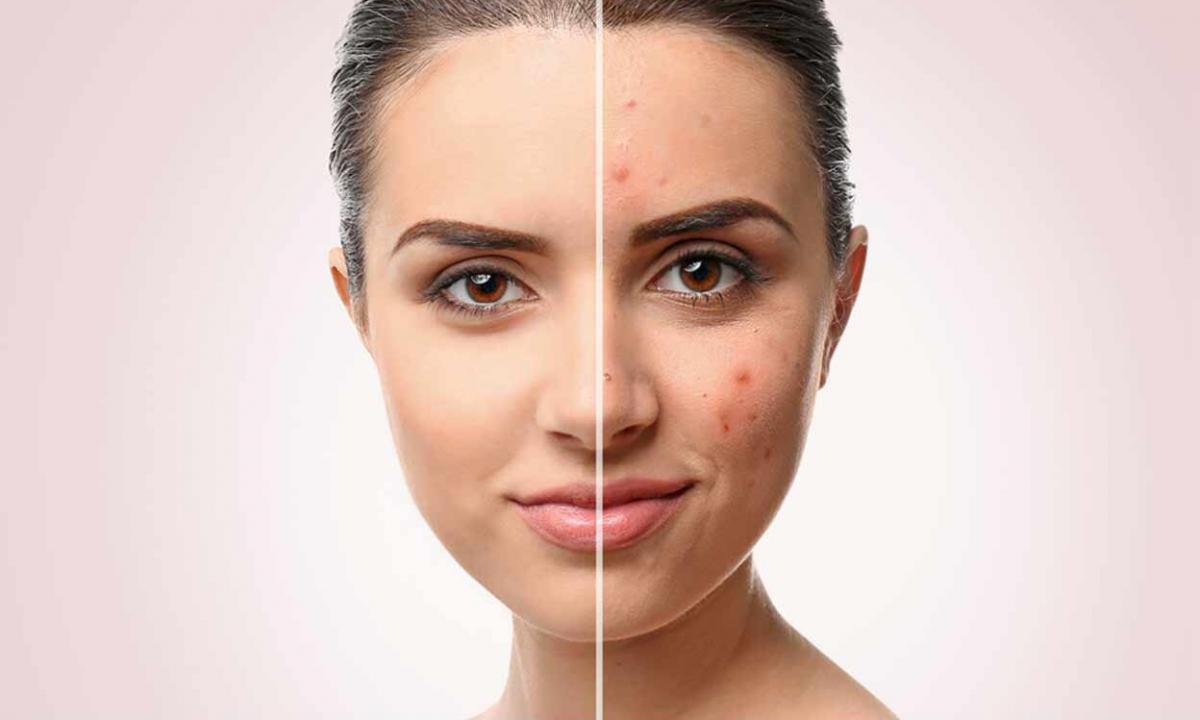 How to get rid from reddening of face skin